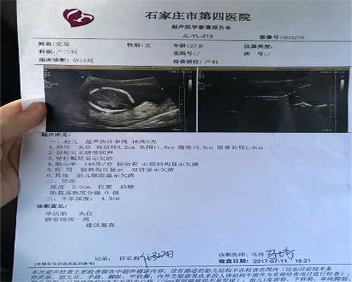 通过超声波图片看到代孕10个月的胎儿_助代孕中