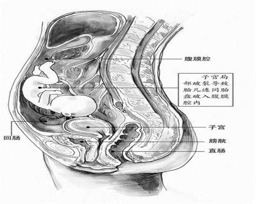 孕期反胃的时间助孕多久胸部会胀痛