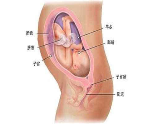 孕期怎么避免脐带扭转
