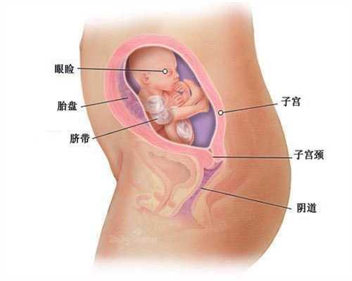 代怀孕一个月内如何堕胎，代怀孕一个月流产怎