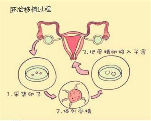 助孕后出现胃出血的原因-孕期保健